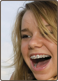 stock photo teen girl wearing metal braces